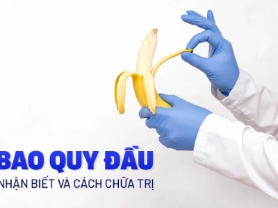 Hẹp bao quy đầu là gì? Dấu hiệu, nguyên nhân và cách điều trị