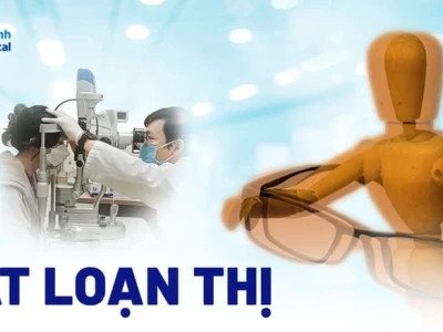 Loạn thị là như thế nào? Nguyên nhân, dấu hiệu và cách điều trị hiệu quả