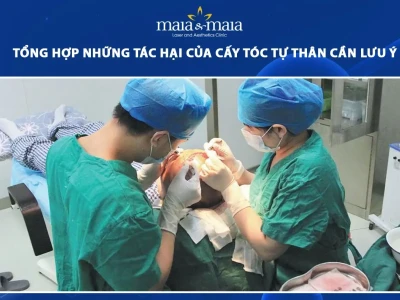 Tác hại của cấy tóc tự thân những điều cần biết