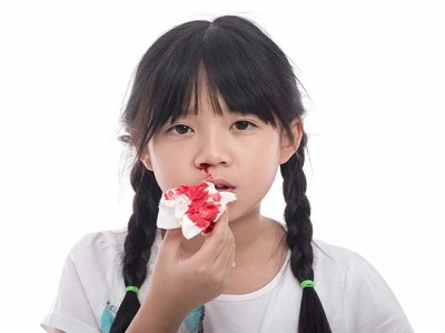 Tại sao hay bị chảy máu mũi? Nguyên nhân, cách xử lý và phòng ngừa hiệu quả