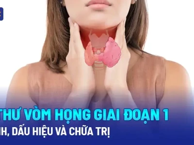 Ung thư vòm họng có biểu hiện như thế nào? Nhận biết sớm để tăng cơ hội sống