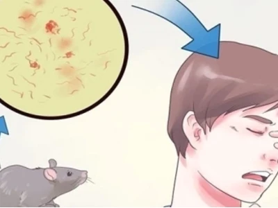 Vết chuột cắn như thế nào dấu hiệu nhận biết và cách xử lý