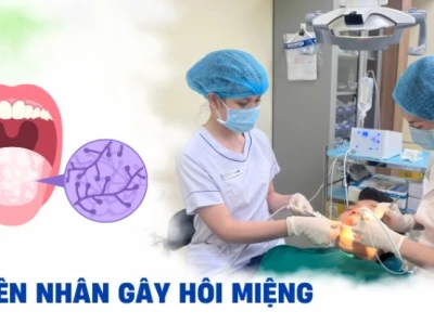 Vì sao bị hôi miệng và cách khắc phục hiệu quả tại nhà
