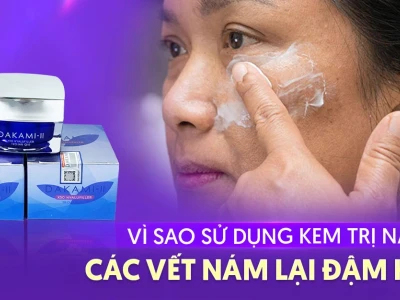 Vì Sao Dùng Kem Trị Nám Lại Khiến Vết Nám Đậm Hơn? Giải Pháp Hiệu Quả