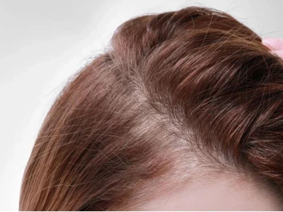 Vì sao tóc con mọc nhiều và cách cải thiện hiệu quả?