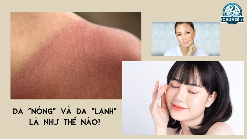 Da “nóng” và da “lạnh” như thế nào?