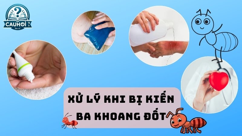 Xử lý khi bị kiến ba khoang đốt