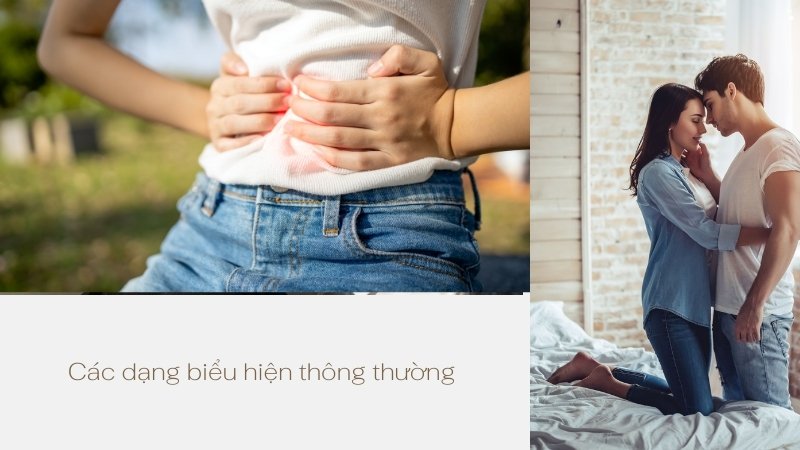 Định nghĩa về cảm giác tức bụng dưới