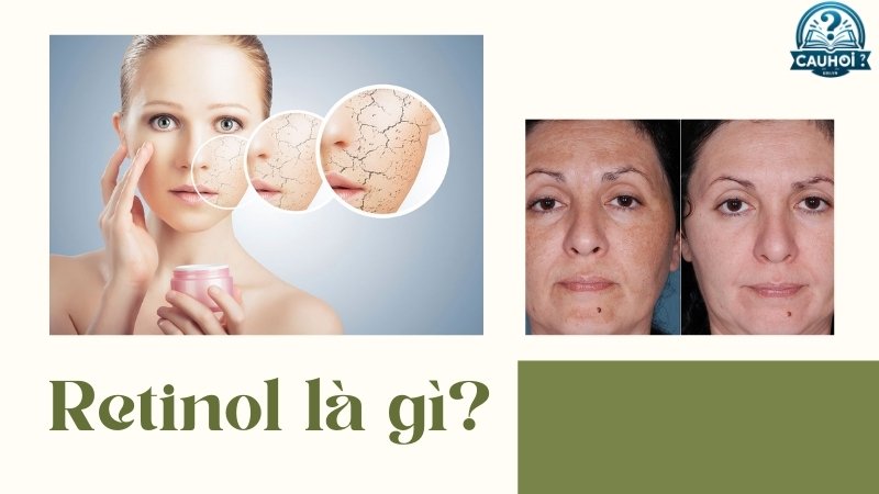 Retinol là gì?