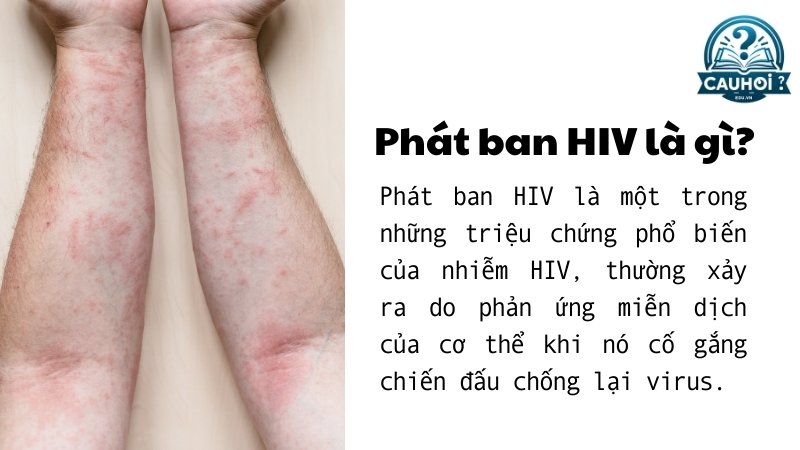 Phát ban HIV là gì?