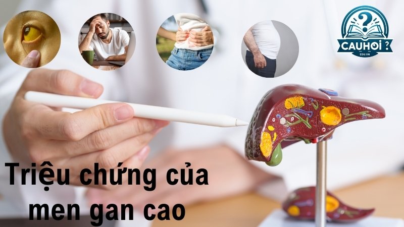 Triệu chứng của men gan cao