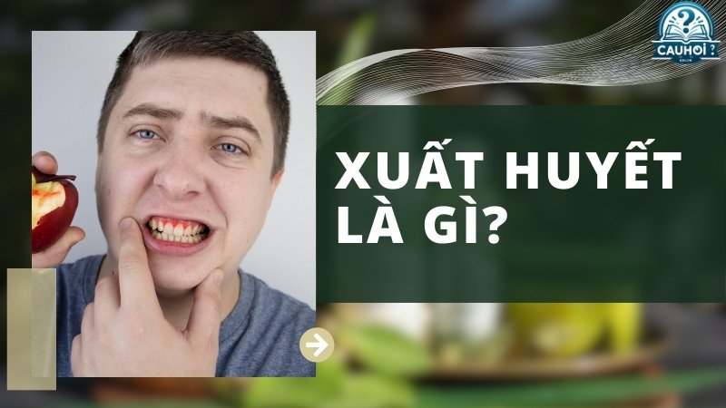 Xuất huyết là gì?