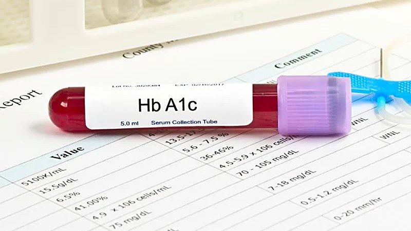 Hba1c là gì 03