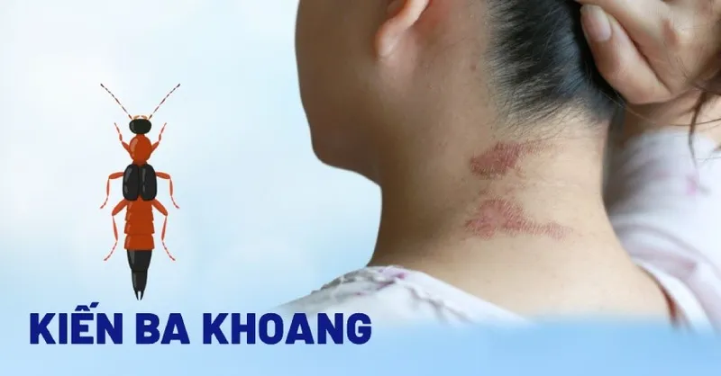 Tác hại của kiến 3 khoang 7