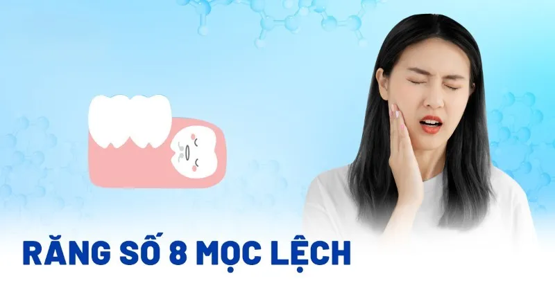 Tác hại của răng số 8 5