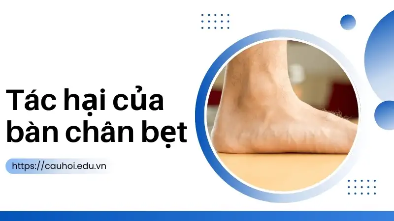 Tác hại bàn chân bẹt - Những rủi ro cho hệ xương khớp