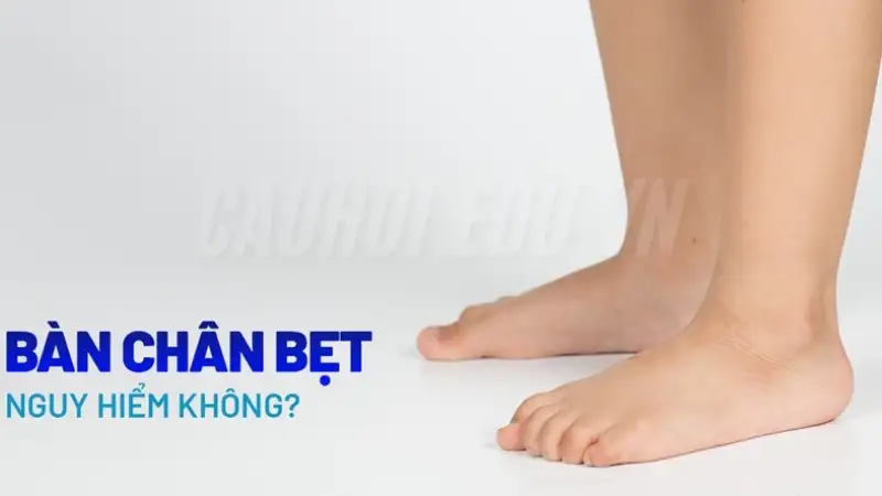 Tác hại của bàn chân bẹt 2